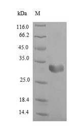 FABP3 / H-FABP Protein - (Tris-Glycine gel) Discontinuous SDS-PAGE (reduced) with 5% enrichment gel and 15% separation gel.