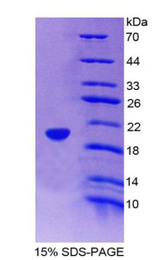 FABP9 / Lipid-Binding Protein Protein - Recombinant  Fatty Acid Binding Protein 9, Testis By SDS-PAGE