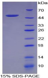 FASLG / Fas Ligand Protein - Recombinant Factor Related Apoptosis Ligand By SDS-PAGE