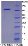 FASLG / Fas Ligand Protein - Recombinant Factor Related Apoptosis Ligand By SDS-PAGE