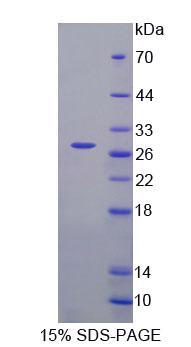 FASTK / FAST Protein - Recombinant Fas Activated Serine/Threonine Kinase (FASTK) by SDS-PAGE