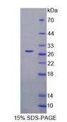 FASTK / FAST Protein - Recombinant Fas Activated Serine/Threonine Kinase (FASTK) by SDS-PAGE