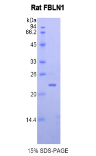 FBLN1 / Fibulin 1 Protein - Recombinant Fibulin 1 By SDS-PAGE