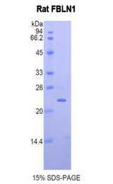FBLN1 / Fibulin 1 Protein - Recombinant Fibulin 1 By SDS-PAGE