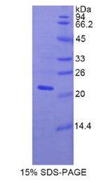 FBLN5 / Fibulin 5 Protein - Recombinant Fibulin 5 By SDS-PAGE