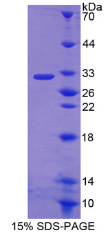 FCAR / CD89 Protein - Recombinant  Fc Fragment Of IgA Receptor By SDS-PAGE