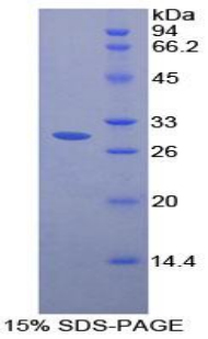 FCGR2 / CD32 Protein - Recombinant Receptor II For The Fc Region Of Immunoglobulin G By SDS-PAGE