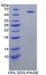 FCGR3A / CD16A Protein - Recombinant Fc Fragment Of IgG Low Affinity IIIa Receptor By SDS-PAGE