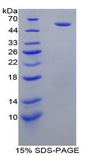 FCGR3A / CD16A Protein - Recombinant Fc Fragment Of IgG Low Affinity IIIa Receptor By SDS-PAGE