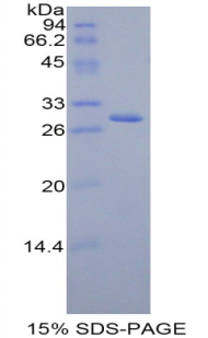 FDFT1 / Squalene Synthase Protein - Recombinant Farnesyl Diphosphate Farnesyltransferase 1 By SDS-PAGE