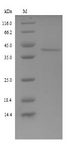 FETUB / Fetuin B Protein - (Tris-Glycine gel) Discontinuous SDS-PAGE (reduced) with 5% enrichment gel and 15% separation gel.