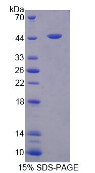 FEZ2 Protein - Recombinant Fasciculation And Elongation Protein Zeta 2 (FEz2) by SDS-PAGE