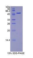 FGF10 Protein - Recombinant Fibroblast Growth Factor 10 By SDS-PAGE