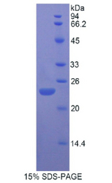 FGF13 Protein - Recombinant Fibroblast Growth Factor 13 By SDS-PAGE