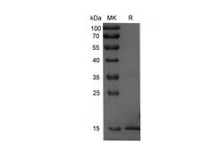 FGF2 / Basic FGF Protein - Recombinant Rat FGF2 Protein (His Tag)-Elabscience