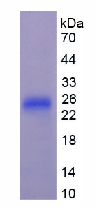 FGF21 Protein - Recombinant Fibroblast Growth Factor 21 (FGF21) by SDS-PAGE
