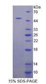 FGF6 Protein - Recombinant  Fibroblast Growth Factor 6 By SDS-PAGE