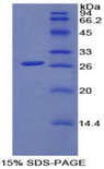 FGFRL1 Protein - Recombinant Fibroblast Growth Factor Receptor Like Protein 1 By SDS-PAGE