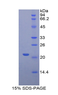 FGL2 Protein - Recombinant Fibrinogen Like Protein 2 By SDS-PAGE