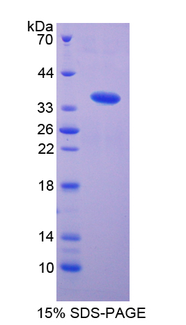 FLT1 / VEGFR1 Protein - Recombinant  Vascular Endothelial Growth Factor Receptor 1 By SDS-PAGE