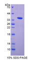 FLT1 / VEGFR1 Protein - Recombinant  Vascular Endothelial Growth Factor Receptor 1 By SDS-PAGE