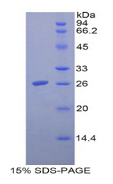 FOLR1 / Folate Receptor Alpha Protein - Recombinant Folate Receptor 1, Adult By SDS-PAGE