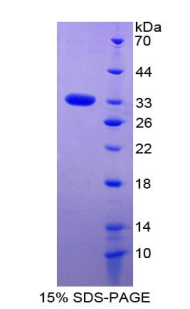 FOXM1 Protein - Recombinant Forkhead Box Protein M1 By SDS-PAGE