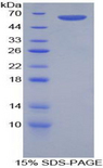 FRA-1 / FOSL1 Protein - Recombinant FOS Like Antigen 1 By SDS-PAGE