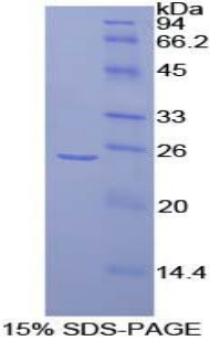 FRS2 Protein - Recombinant Fibroblast Growth Factor Receptor Substrate 2 By SDS-PAGE