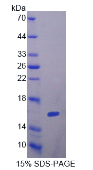 FSHB / FSH Beta Protein - Recombinant  Follicle Stimulating Hormone Beta By SDS-PAGE