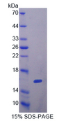 FSHB / FSH Beta Protein - Recombinant  Follicle Stimulating Hormone Beta By SDS-PAGE