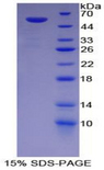 G6PD Protein - Recombinant Glucose 6 Phosphate Dehydrogenase By SDS-PAGE