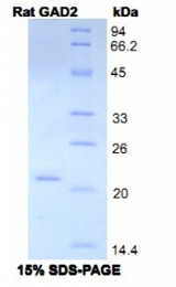GAD65 Protein - Recombinant Glutamate Decarboxylase 2, Acid By SDS-PAGE