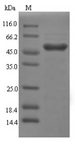 GAL4 / Galectin 4 Protein - (Tris-Glycine gel) Discontinuous SDS-PAGE (reduced) with 5% enrichment gel and 15% separation gel.