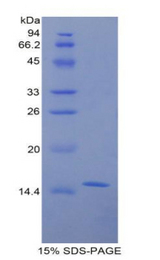 GALC / Galactocerebrosidase Protein - Recombinant Galactosylceramidase By SDS-PAGE