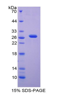 GALNS / Chondroitinase Protein - Recombinant N-Acetylgalactosamine-6-Sulfatase By SDS-PAGE