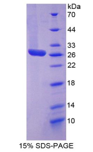 GAP43 Protein