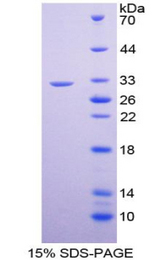 GATA1 Protein - Recombinant GATA Binding Protein 1 By SDS-PAGE
