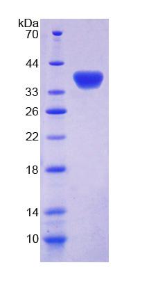 GBP4 / Mpa2 Protein - Recombinant Guanylate Binding Protein 4 By SDS-PAGE