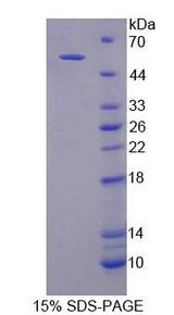 GCK / Glucokinase Protein - Recombinant Glucokinase (GCK) by SDS-PAGE