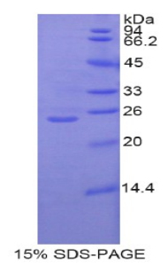 GCLC Protein - Recombinant Glutamate Cysteine Ligase, Catalytic By SDS-PAGE