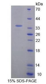 Geminin Protein - Recombinant Geminin By SDS-PAGE