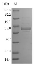 GFER Protein - (Tris-Glycine gel) Discontinuous SDS-PAGE (reduced) with 5% enrichment gel and 15% separation gel.