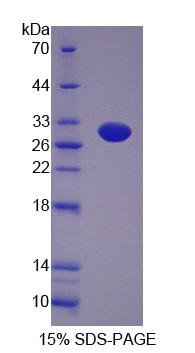 GFM2 Protein - Recombinant G-Elongation Factor, Mitochondrial 2 (GFM2) by SDS-PAGE
