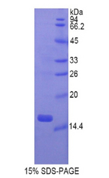 GKN1 / Gastrokine 1 Protein - Recombinant Gastrokine 1 By SDS-PAGE
