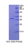 GLB1 / Beta-Galactosidase Protein - Recombinant Galactosidase Beta By SDS-PAGE