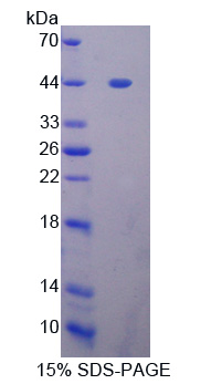 GLI / GLI1 Protein - Recombinant  GLI Family Zinc Finger Protein 1 By SDS-PAGE