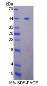 GLI / GLI1 Protein - Recombinant  GLI Family Zinc Finger Protein 1 By SDS-PAGE