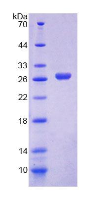 GLNRS / QARS Protein - Recombinant Glutaminyl tRNA Synthetase (QARS) by SDS-PAGE