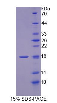 GLOD2 / MCEE Protein - Recombinant Methylmalonyl Coenzyme A Epimerase (MCEE) by SDS-PAGE